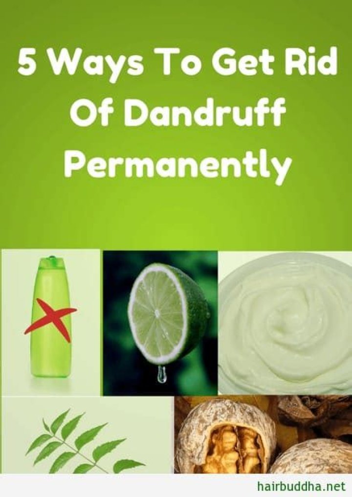 How to remove dandruff quickly